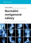 Normální rentgenové nálezy - Torsten B. Möller