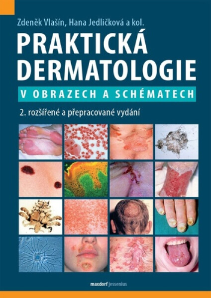 Praktická dermatologie v obrazech a schématech - Zdeněk Vlašín