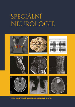 Speciální neurologie - Petr Kaňovský, Andrea Bártková