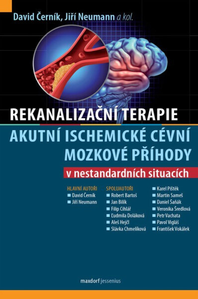 Rekanalizační terapie akutní ischemické cévní mozkové příhody v nestandardních situacích - Jiří Neumann
