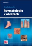 Revmatologie obrazech Marta Olejárová