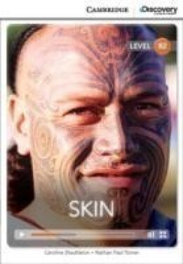 Skin Upper Intermediate Book with Online Access - Shackleton, Caroline; Turner, Nathan Paul