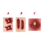 Jizvy samolepící, 3 druhy