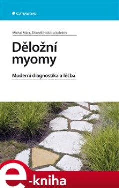Děložní myomy. Moderní diagnostika a léčba - Michal Mára, Zdeněk Holub e-kniha