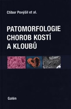 Patomorfologie chorob kostí kloubů