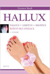 Hallux - Řešení bez operace - Carsten Stark