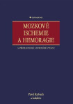 Mozkové ischemie a hemoragie - Pavel Kalvach