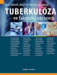 Tuberkulóza ve faktech obrazech Martina Vašáková,