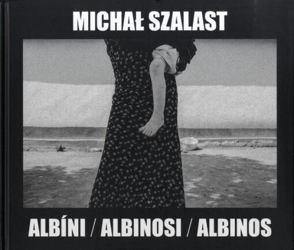 Albíni, Albinosi, Albinos Vladimír Birgus,