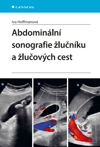 Abdominální sonografie žlučníku a žlučových cest - Iva Hoffmanová