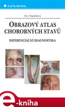 Obrazový atlas chorobných stavů. Diferenciální diagnostika - Eva Topinková e-kniha