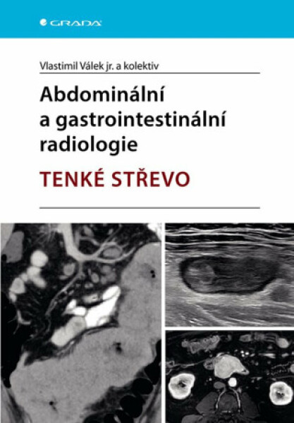 Abdominální a gastrointestinální radiologie - Tenké střevo - Vlastimil Válek