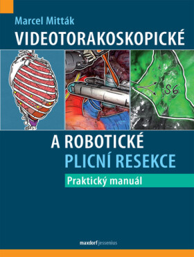 Videotorakoskopické a robotické plicní resekce - Marcel Mitták