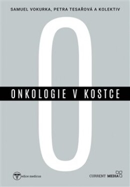 Onkologie v kostce - Petra Tesařová