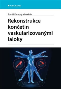 Rekonstrukce končetin vaskularizovanými laloky Tomáš Kempný,