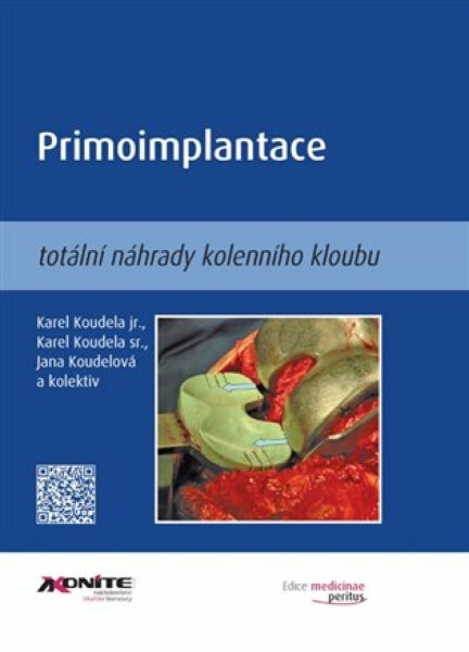 Primoimplantace totální náhrady kolenního kloubu - Karel Koudela jr., Karel Koudela st., Jana Koudelová