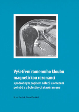 Vyšetření ramenního kloubu magnetickou rezonancí s podrobným popisem nálezů u omezení pohybů u bolestivých stavů ramene - Boris Pauček, David Smékal -