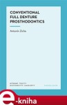 Conventional Full Denture Prosthodontics - Antonín Zicha e-kniha