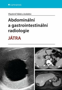 Abdominální a gastrointestinální radiologie - Vlastimil Válek - e-kniha