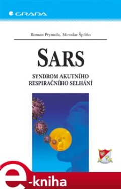 SARS. Syndrom akutního respiračního selhání - Roman Prymula, Miroslav Špliňo e-kniha