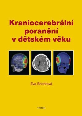 Kraniocerebrální poranění v dětském věku - Eva Brichtová