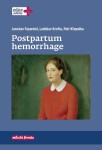 Postpartum hemorrhage Jaroslav Feyereisl