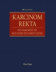 Karcinom rekta