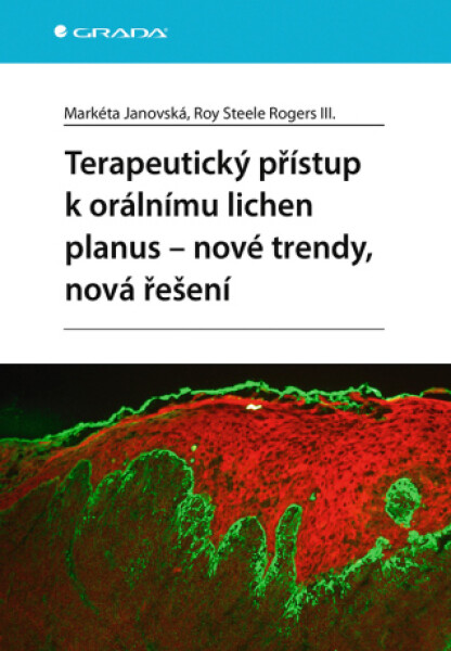 Terapeutický přístup k orálnímu lichen planus - nové trendy, nová řešení - Markéta Janovská, Roy Steele Rogers III. - e-kniha