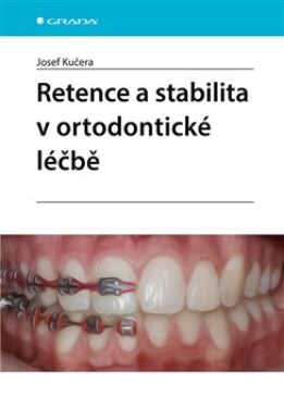 Retence stabilita ortodontické léčbě