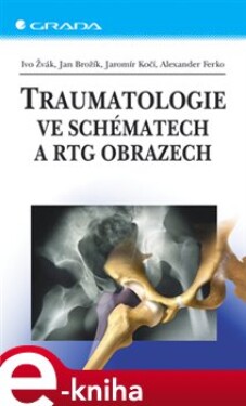Traumatologie ve schématech a RTG obrazech - Ivo Žvák, Jan Brožík, Jaromír Kočí, Alexander Ferko e-kniha