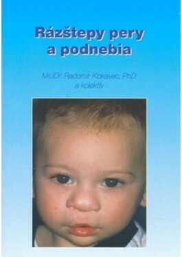 Rázštepy pery podnebia