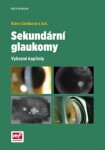 Sekundární glaukomy Klára Samková