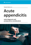 Acute appendicitis - e-kniha