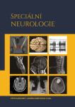 Speciální neurologie - Petr Kaňovský, Andrea Bártková