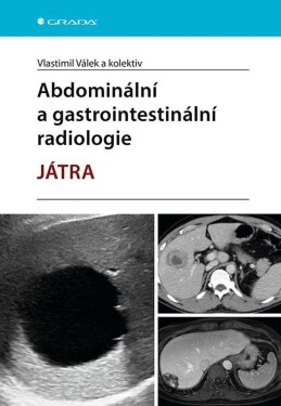 Abdominální a gastrointestinální radiologie - Játra - Vlastimil Válek