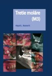 Tretie moláre (M3)