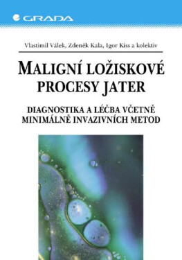 Maligní ložiskové procesy jater - Zdeněk Kala, Igor Kiss, Vlastimil Válek