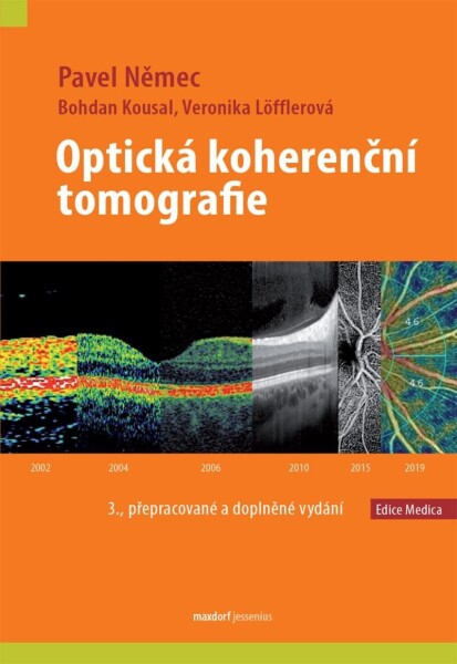 Optická koherenční tomografie