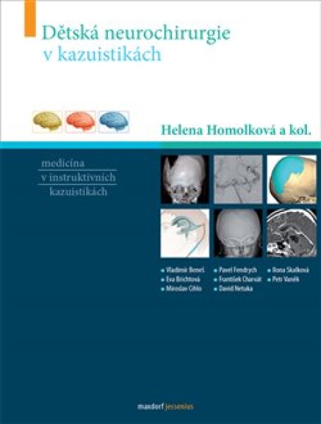 Dětská neurochirurgie kazuistikách