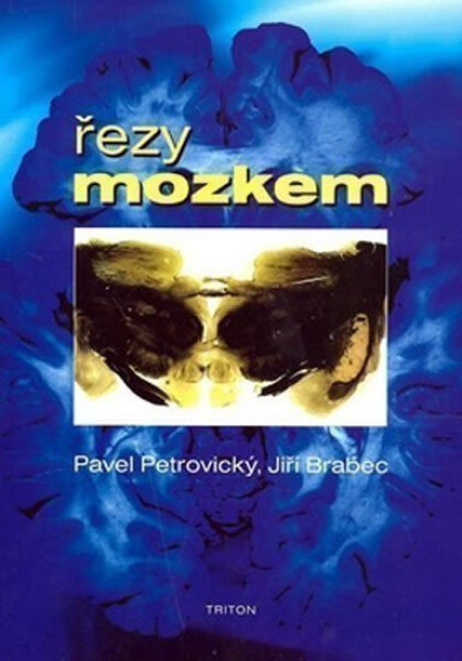Řezy mozkem - Anatomické, , mikroskopické a magnetické - kolektiv autorů