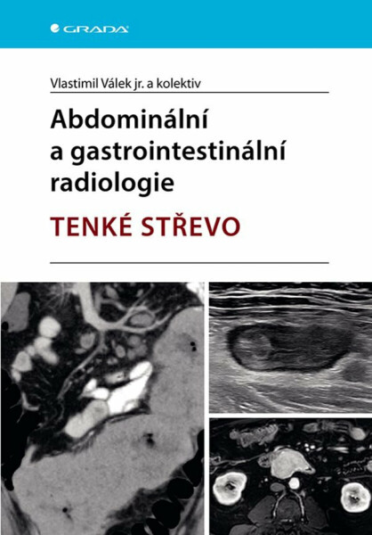 Abdominální a gastrointestinální radiologie - Tenké střevo - Vlastimil Válek