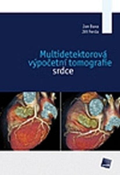 Multidetektorová výpočetní tomografie srdce Jan Baxa