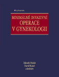 Minimálně invazivní operace v gynekologii - David Kužel, Zdeněk Holub