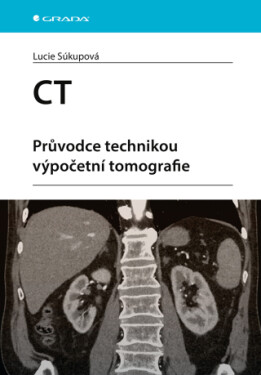 CT - Průvodce technikou výpočetní tomografie - Lucie Súkupová - e-kniha