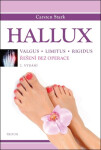 Hallux - Řešení bez operace - Carsten Stark