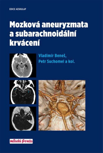 Mozková aneurysmata subarachnoidální krvácení Vladimír Beneš