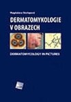 Dermatomykologie v obrazech - Dermatomycology in Pictures - Magdalena Skořepová