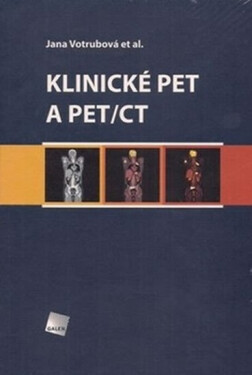 Klinické PET a PET/CT - Jana Votrubová