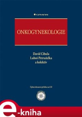 Onkogynekologie - David Cibula, Luboš Petruželka e-kniha