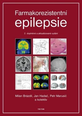 Farmakorezistentni epilepsie - 2. vydání - kolektiv autorů